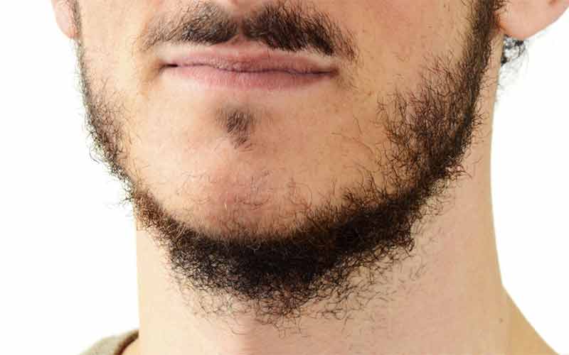 علت کم پشتی ریش و سبیل