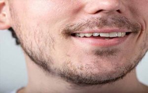 علت کم پشتی ریش و سبیل | علت کم پشت بودن ریش | دلایل کم پشتی ریش و سبیل