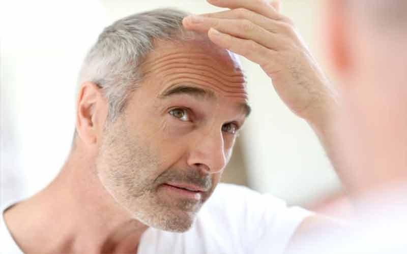 مزیت های سرکه سیب برای مو | خواص و مضرات سرکه سیب برای موی سر