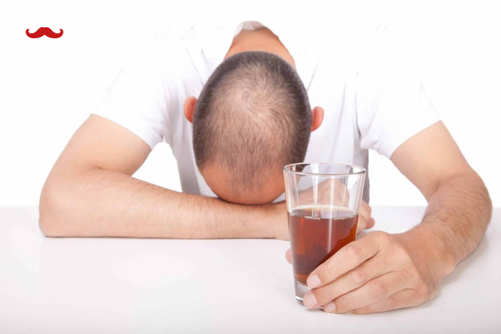 تاثیر مصرف الکل بر ریزش مو