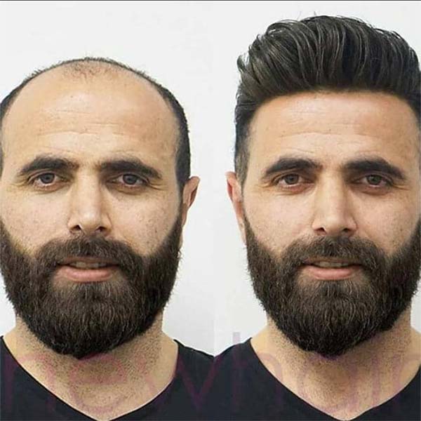 آموزش ترمیم مو در تهران