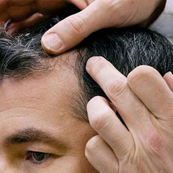 صفر تا صد آموزش ترمیم مو