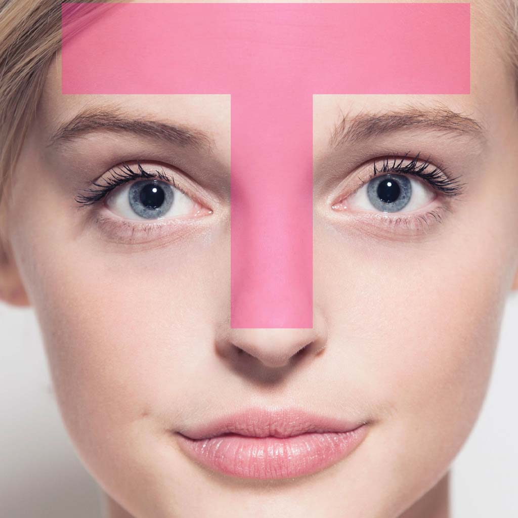 منطقه T پوست چیست؟